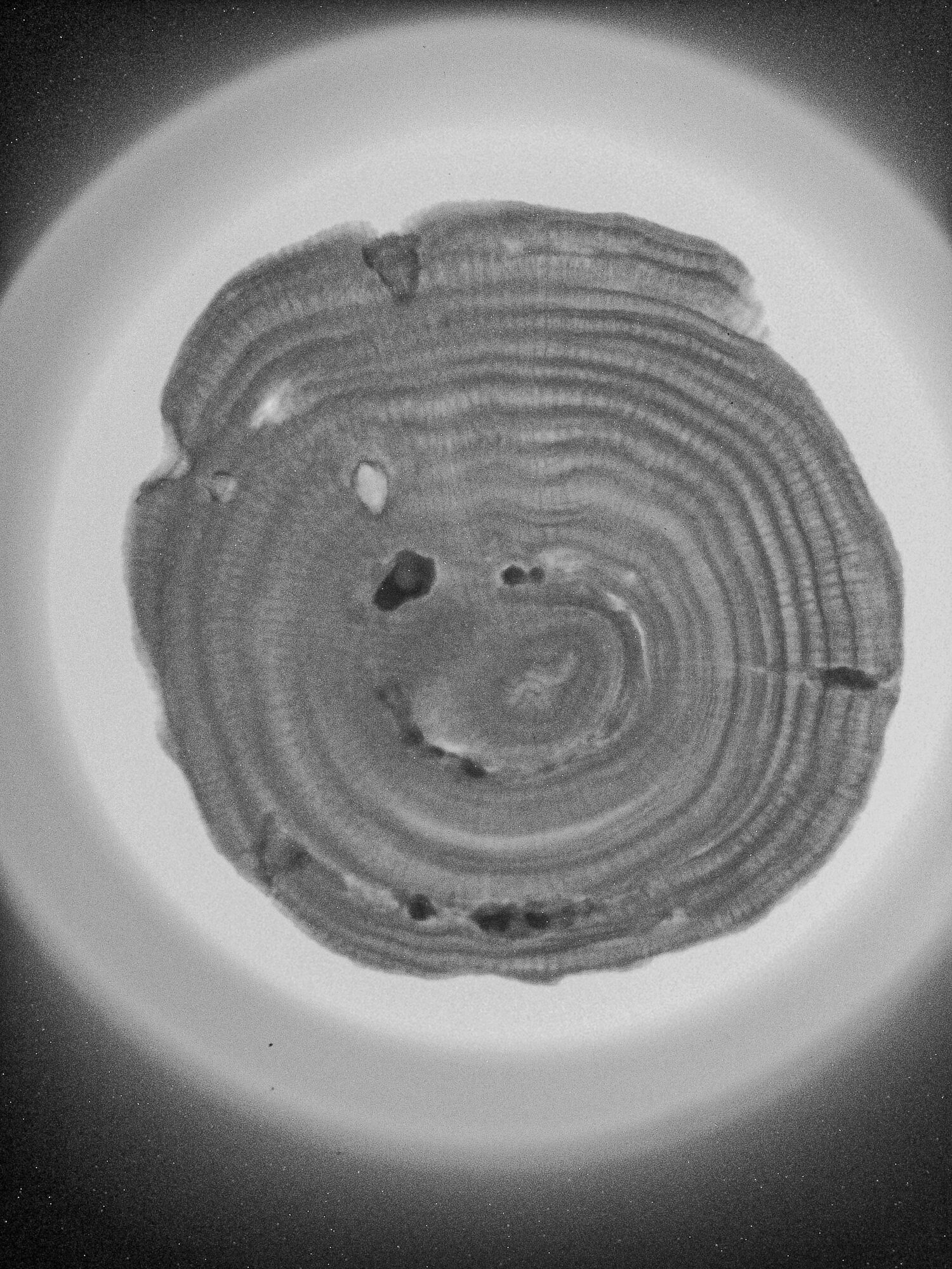 Röntgenbild einer fossilen Porites Rollkoralle aus dem Wiener Becken. Röntgenbild einer fossilen Porites Rollkoralle aus dem Wiener Becken. Die Koralle zeigt deutliche Wachstumsbänder ähnlich den Jahresringen von Bäumen. Dabei handelt es sich um Dichteunterschiede im Kalkskelett, die nur im Röntgenbild sichtbar sind. Sie geben Auskunft über das Wachstum der Koralle. Jedes Paar aus einem hellen und einem dunklen Band steht für ein Jahr Wachstum.