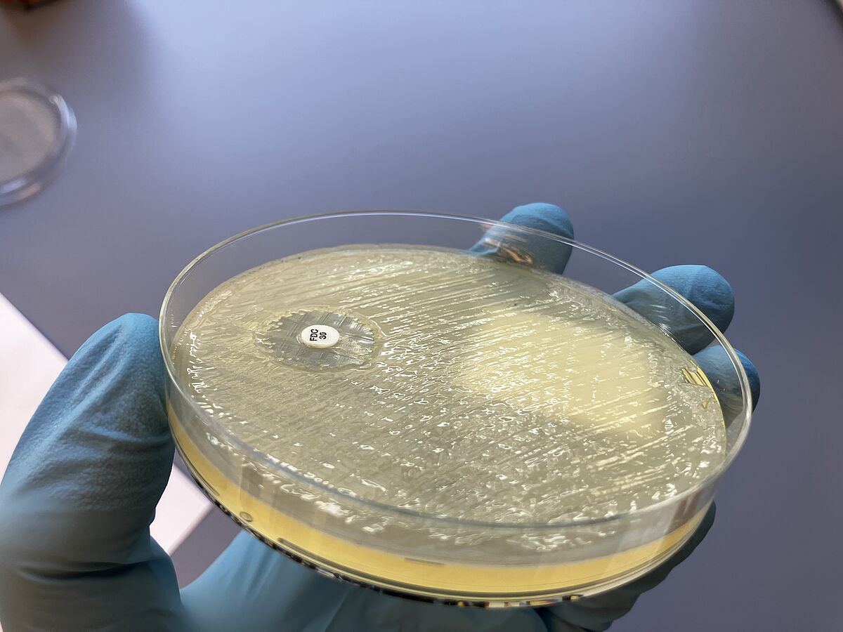 A hand wearing blue gloves is holding a petri dish with an agar plate. Bacteria colonies and a test disc can be seen on it.